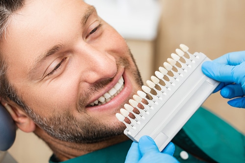 Las carillas dentales son la clave para una sonrisa viva John Hopkins, DDS