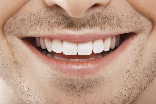 Full-Mouth Reconstruction Rebuild Your Smile Gulfport, MS