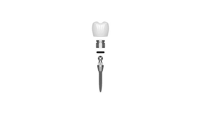 Mini Implants in Gulfport, MS | New Teeth | Mini Implant Dentistry