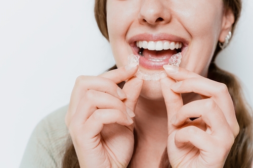 Invisalign Alternativas en Gulfport, MS | Reserve una consulta gratuita